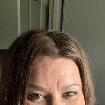 Sublime Medical Aesthetics - Monday: deep 11 lines - Laser Hair Removal Near Me - Riverside, California Sublime Medical Aesthetics - Monday: deep 11 lines - Laser Hair Removal Near Me - Riverside, California