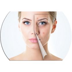 The LAB - Laser and Beauty Specialists - Acne, Acne Scars & Enlarged Pores