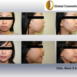 Global Cosmetic Clinic - See the changes?