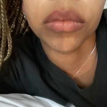 Ataraxy Aesthetics - 1 day after lip blushing & the color is already poppin! - Permanent Makeup Near Me Ataraxy Aesthetics - 1 day after lip blushing & the color is already poppin! - Permanent Makeup Near Me