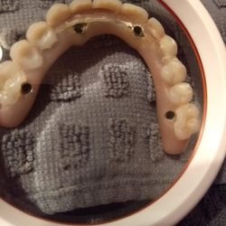 Didier Guillaume, DMD - Guillaume Prosthesis: Patches, plugs, breaks
