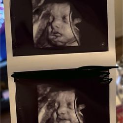 Blossom Baby - Beautiful photos of my husband and I's little one