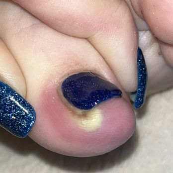 Luxury Nails and Spa - couple days after - Nail Salons Near Me - La Habra, California Luxury Nails and Spa - couple days after - Nail Salons Near Me - La Habra, California