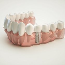Family Smiles Dental Care