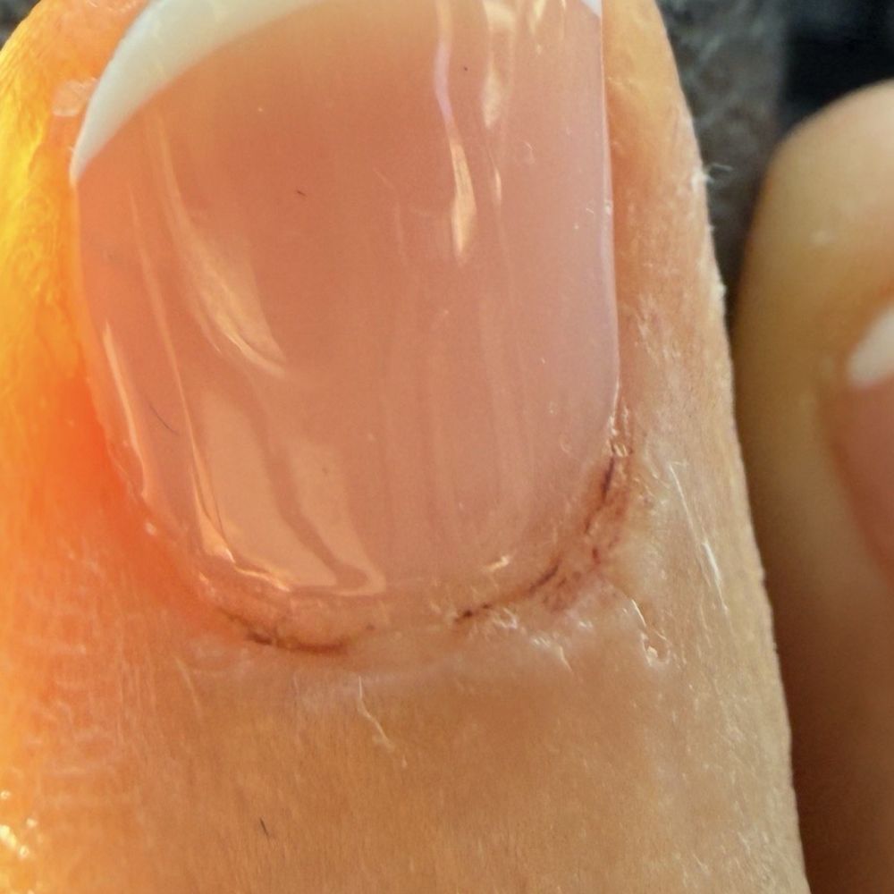Nail Chic - Wound during nail - Nail Salons Near Me - Newark, California Nail Chic - Wound during nail - Nail Salons Near Me - Newark, California