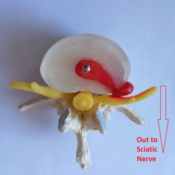 Reactivate Chiropractic & Rehab - Disc Herniation and Sciatica - Chiropractors Near Me - Tulsa, Oklahoma Reactivate Chiropractic & Rehab - Disc Herniation and Sciatica - Chiropractors Near Me - Tulsa, Oklahoma