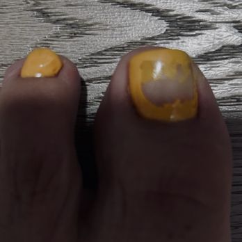 Luxury Nails & Spa - My pedicure went wrong - Nail Salons Near Me - Diamond Bar, California Luxury Nails & Spa - My pedicure went wrong - Nail Salons Near Me - Diamond Bar, California