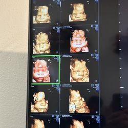 Baby Selfie 3d4d