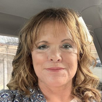 Brett Stompro, MD & Chester Cheng, MD - 6 week post op Facelift - Cosmetic Surgeons Near Me - Livermore, California Brett Stompro, MD & Chester Cheng, MD - 6 week post op Facelift - Cosmetic Surgeons Near Me - Livermore, California