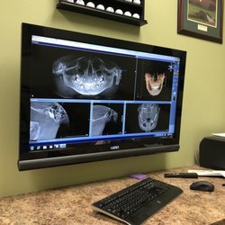 Mooso Orthodontics - 3-D skull scan on the screen