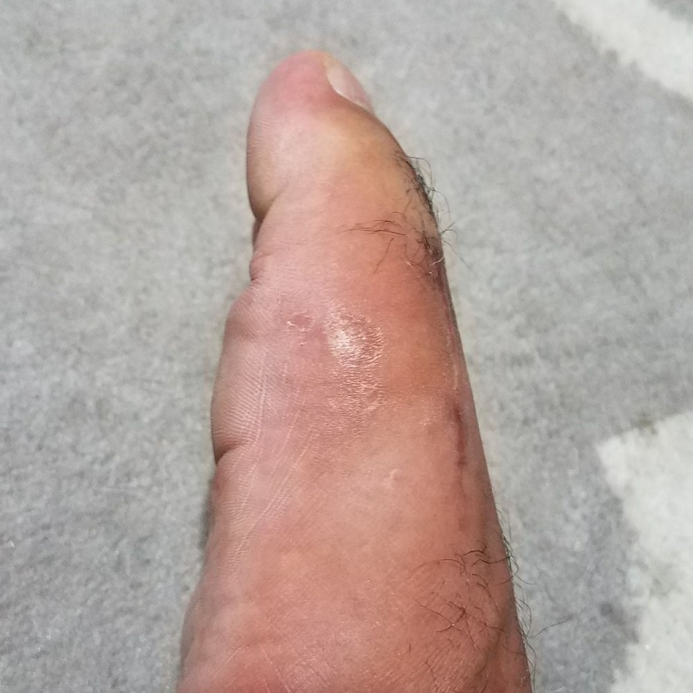 Gregory Morris, DPM - After it's done and healed to the point of walking and running normal. - Podiatrists Near Me - Honolulu, Hawaii