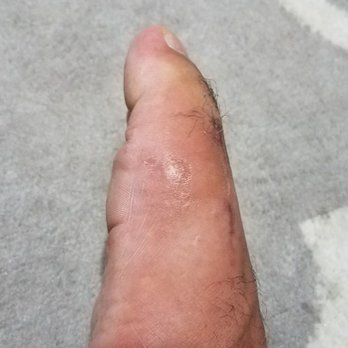 Gregory Morris, DPM - After it's done and healed to the point of walking and running normal. - Podiatrists Near Me - Honolulu, Hawaii