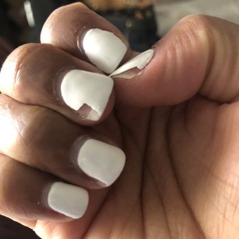 XoXo Nails & Spa - Chipped* gel coming all the way up on my nails - Nail Salons Near Me - Madison, Tennessee XoXo Nails & Spa - Chipped* gel coming all the way up on my nails - Nail Salons Near Me - Madison, Tennessee