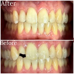 Glee Dentistry - Same day emergency treatment.