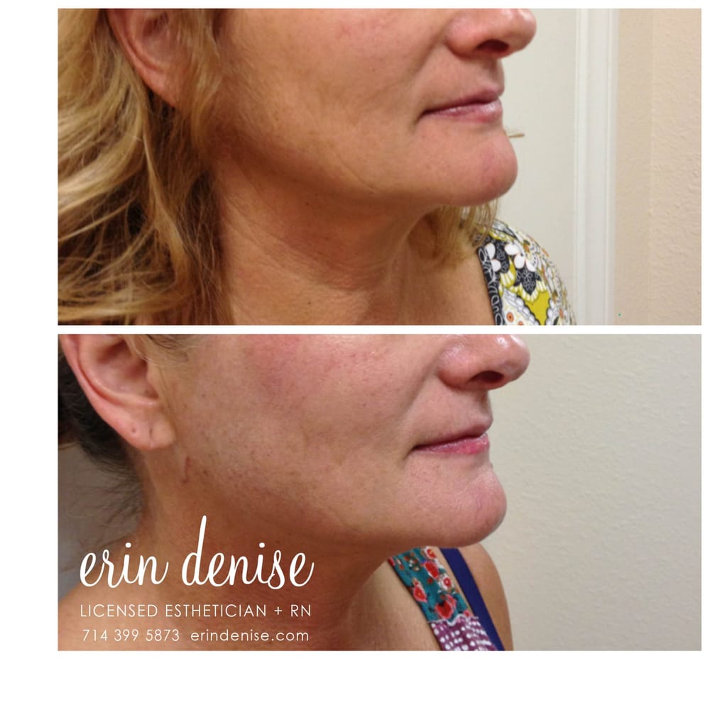 Erin Denise Skincare Logo