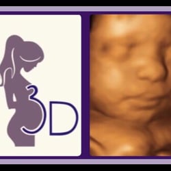 3D Maternity Imaging - Beautiful images taken by our highly trained technicians !