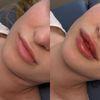 Luna Aesthetics MedSpa gift card