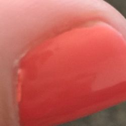 Beauty Nail - Flooded cuticles