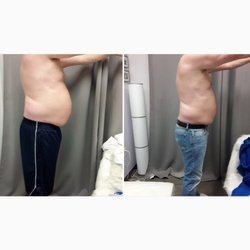Skinny Glow Lipo