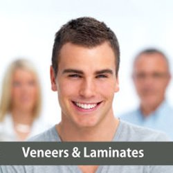 San Rafael Dentistry - Veneers & Laminates