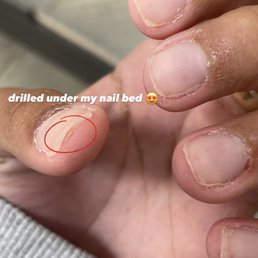 If you read .. this is the part where she drills under my "nail" If you read .. this is the part where she drills under my "nail"