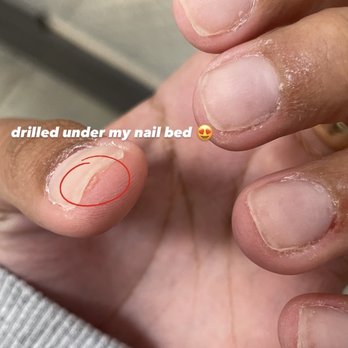 Diva Nails - If you read .. this is the part where she drills under my "nail" - Skin Care Near Me - Hawaiian Gardens, California Diva Nails - If you read .. this is the part where she drills under my "nail" - Skin Care Near Me - Hawaiian Gardens, California