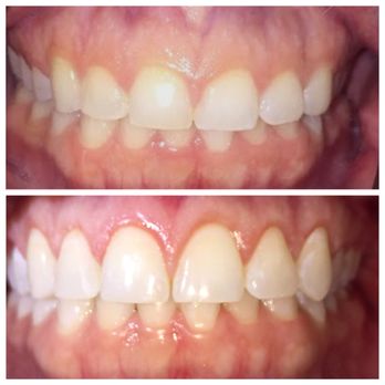Summer Gutschow, DDS - Pediatric Dentists Near Me - Omaha, Nebraska Summer Gutschow, DDS - Pediatric Dentists Near Me - Omaha, Nebraska