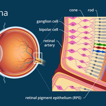 Oregon Eye Consultants - Retina Diagram - Laser Eye Surgery/Lasik Near Me - Springfield, Oregon Oregon Eye Consultants - Retina Diagram - Laser Eye Surgery/Lasik Near Me - Springfield, Oregon