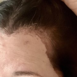 Foiled - Hair dye on skin