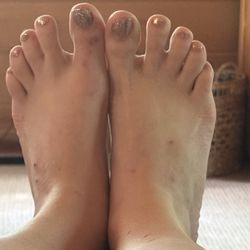 Pedicure (ignore the scratches I have kittens)