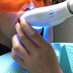 Jason C Ako, DDS - Teeth whitening. Glasses so your eyes are safe.