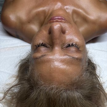 Hydro Glow Facial - Before & After This beautiful transformation was achieved with a HydroPeptide Oxygen Treatment + Dermaplaning. - Skin Care Near Me - Brea, California Hydro Glow Facial - Before & After This beautiful transformation was achieved with a HydroPeptide Oxygen Treatment + Dermaplaning. - Skin Care Near Me - Brea, California