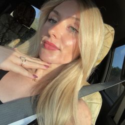 R Skin Aesthetics by Raquel - 6 days post lip flip