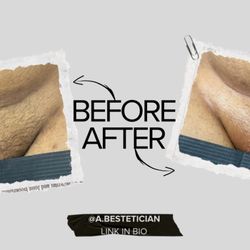 A Bestetician - Before and After of a Brazilian Wax