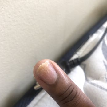 V'S Nails & Spa - I now have a fungal infection thanks to their dirty ass salon - Nail Salons Near Me - Hanover Park, Illinois