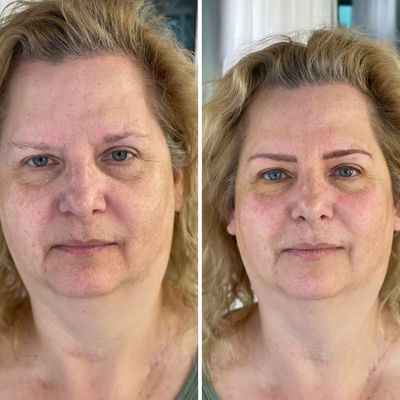 It's just new brows..it's a facelift! - Microblading a natural brow and a subtle eyeliner.....looks like she had work done! It's just new brows..it's a facelift! - Microblading a natural brow and a subtle eyeliner.....looks like she had work done!