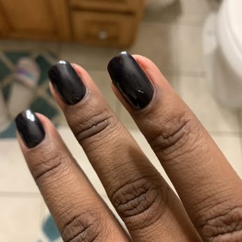 Lux Nails & Spa - The other hand with the same red discoloration. - Waxing Near Me - Dedham, Massachusetts Lux Nails & Spa - The other hand with the same red discoloration. - Waxing Near Me - Dedham, Massachusetts