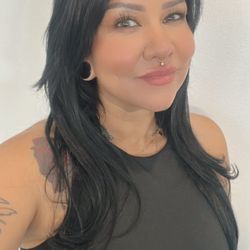 Awaken MD - After 3 sessions with Lucy for Botox & Filler.