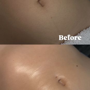 Sugar By Char - Stomach sugar - Sugaring Near Me - Corona, California Sugar By Char - Stomach sugar - Sugaring Near Me - Corona, California