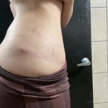 Daniel G Kolder, MD - Pacifica Center for Plastic Surgery - Wraps around to back. - Cosmetic Surgeons Near Me - Camarillo, California