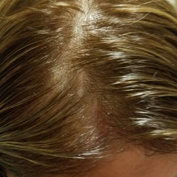 Salon Image TM - greased my hair.my scalp bled and got burned! I should report them to California board of barbering. - Hair Salons Near Me - Carson, California Salon Image TM - greased my hair.my scalp bled and got burned! I should report them to California board of barbering. - Hair Salons Near Me - Carson, California