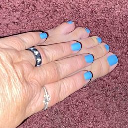 Fingers and toes. Fingers and toes.