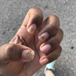 Sophia Nails & Spa - FUNGUS ON MY NAILS