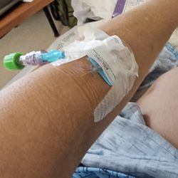 Portneuf Medical Center - This is my IV that was moved 4 times! This is where it finally came to live. This IV didn't hurt-Johnnie put this IV in. Good job Johnnie!!!