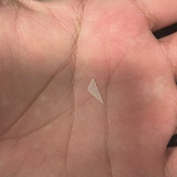 Piece of sharp hard plastic found in my food