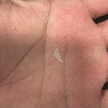 7 Flag Restaurant & Cafe - Piece of sharp hard plastic found in my food - Middle Eastern Near Me - Los Angeles, California