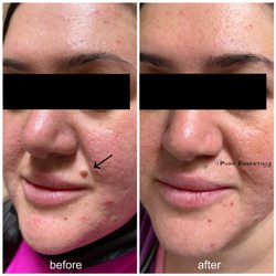 Pure Essentials - Corrective skin care tx