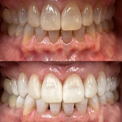 Ates Dental Studio