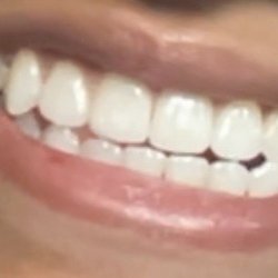 Gentle Dental Care
