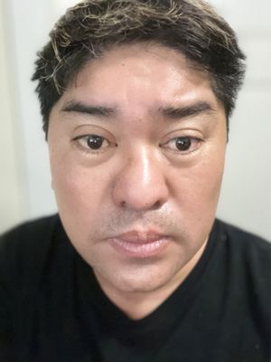 Mirame Skin Treatments by null